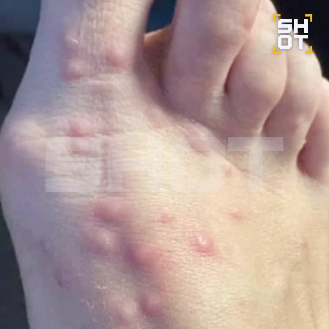 Bu göldə təhlükəli virus yayıldı - ŞOK FOTOLAR