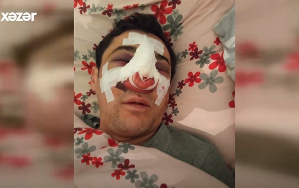 Bakıda avtobus sürücüsü döyüldü – ANBAAN VİDEO Bakıda avtobus sürücüsü döyüldü – ANBAAN VİDEO