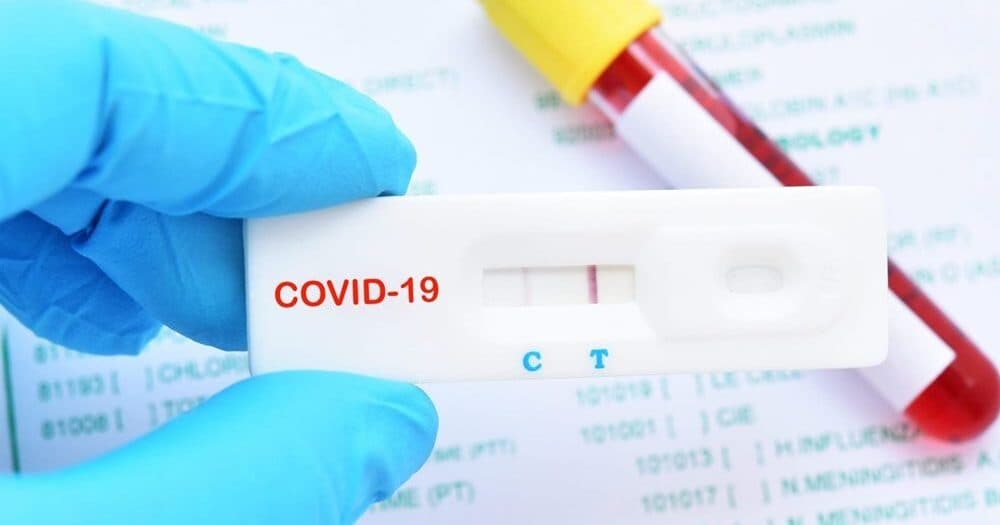 Koronavirus testlərinin cavabı niyə gecikir? – TƏBİB-dən açıqlama Koronavirus testlərinin cavabı niyə gecikir? – TƏBİB-dən açıqlama