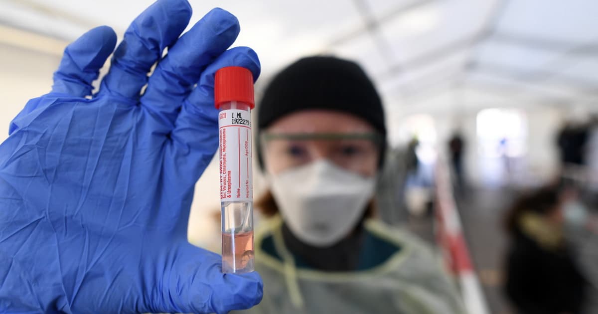 Koronavirus statistikası: Ölüm sayı ARTDI Koronavirus statistikası: Ölüm sayı ARTDI