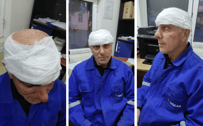 “Azəriqaz” əməkdaşına hücum EDİLDİ “Azəriqaz” əməkdaşına hücum EDİLDİ