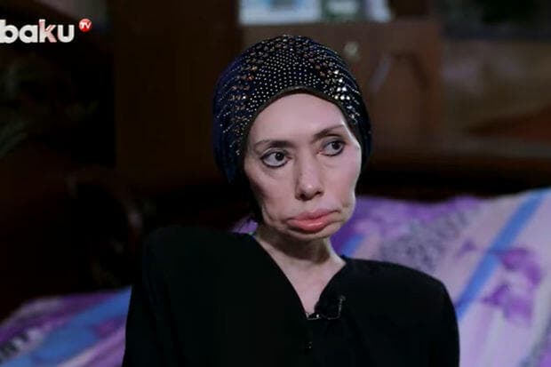 Ayna Sultanovanın nəticəsi: “Erməni tibb bacısı məni əlil etdi” – VİDEO Ayna Sultanovanın nəticəsi: “Erməni tibb bacısı məni əlil etdi” – VİDEO