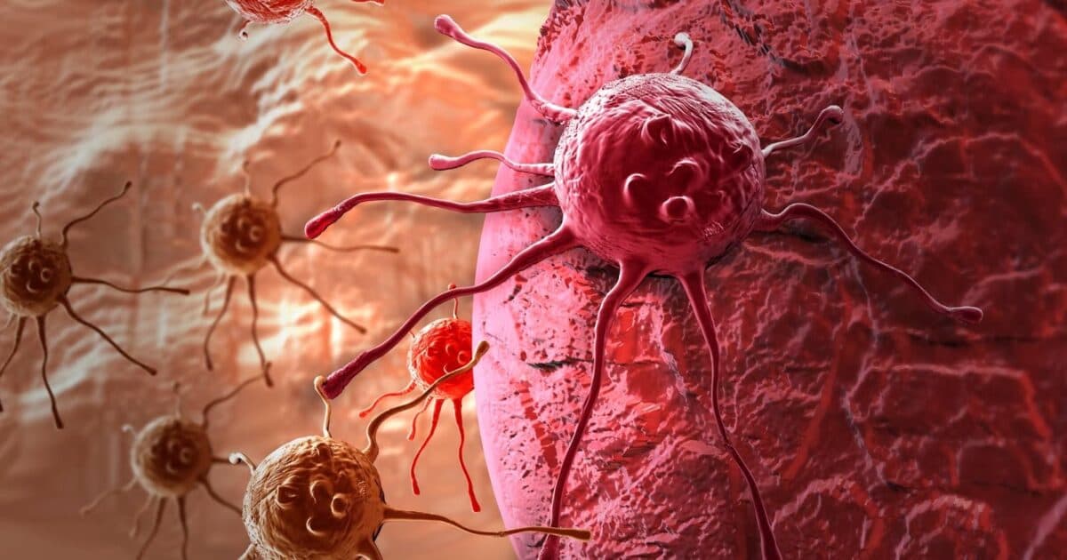 Dünyada xərçəng niyə sürətlə cavanlaşır? – Alimlər XƏBƏRDARLIQ EDİR Dünyada xərçəng niyə sürətlə cavanlaşır? – Alimlər XƏBƏRDARLIQ EDİR