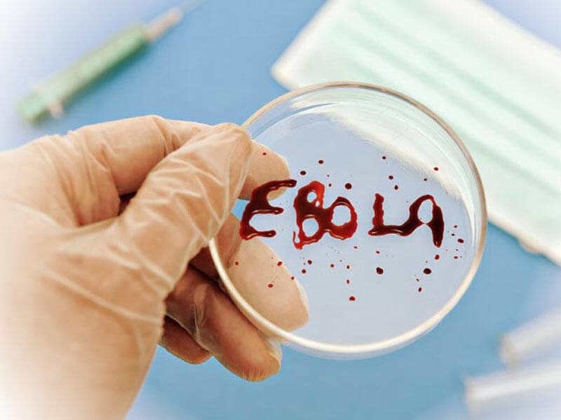 Ebola qurbanlarının sayı 1 354-ə çatdı Ebola qurbanlarının sayı 1 354-ə çatdı