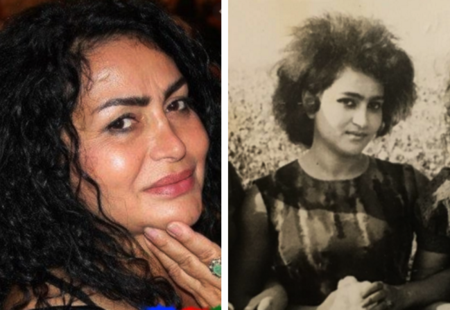Şou-biznesdəki qadınların ƏVVƏLKİ və SONRAKI HALI - FOTOLAR