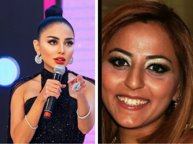 Şou-biznesdəki qadınların ƏVVƏLKİ və SONRAKI HALI - FOTOLAR
