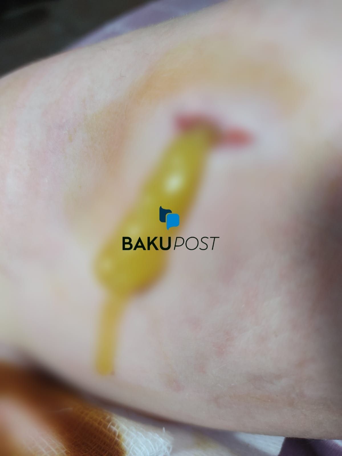 Bakupost.az