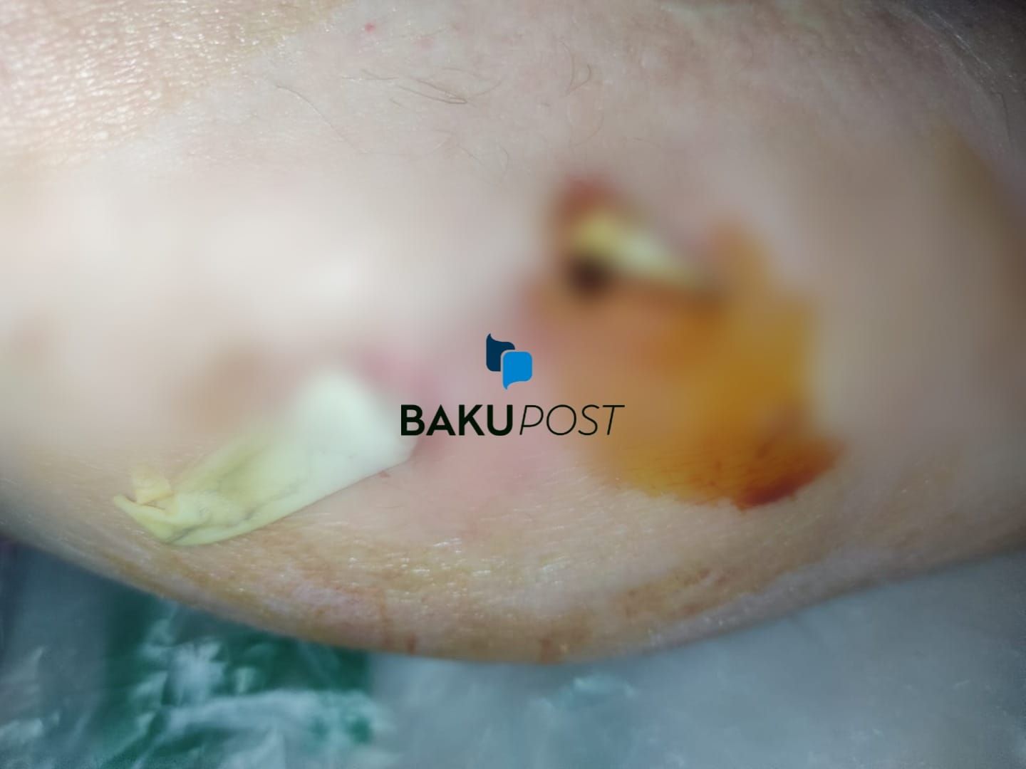 Bakupost.az