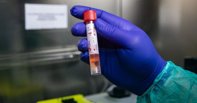 Koronavirusdan daha 5 nəfər öldü – Yoluxma sayı