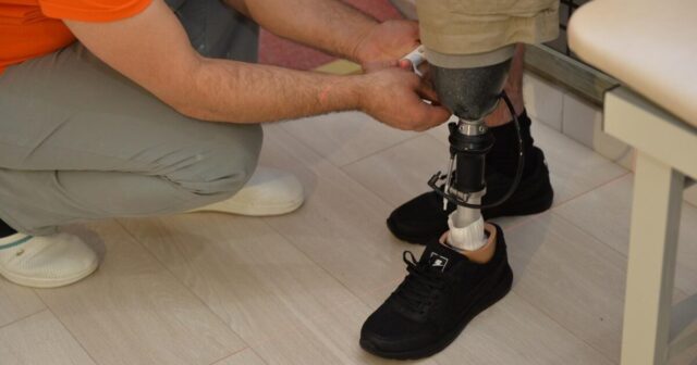 50 qazinin protezlərlə təminatı prosesi yekunlaşır