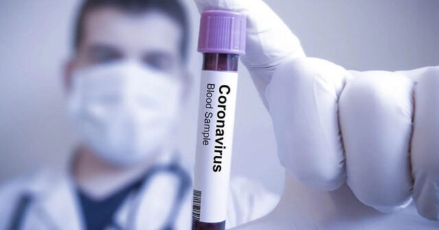 Son bir ayda 21 nəfər koronavirusdan ölüb
