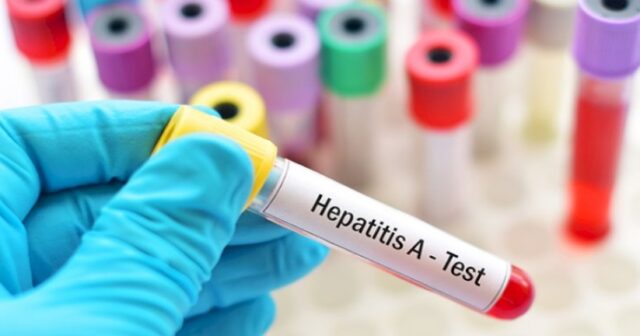 Regionlarda hepatit A virusuna yoluxma müşahidə edilir – TƏBİB
