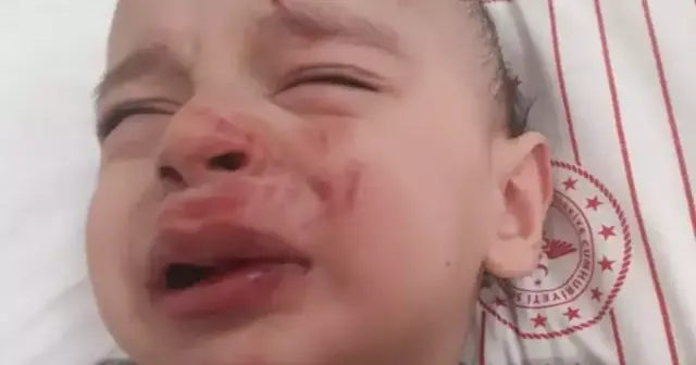 Türkiyədə sahibsiz it dəhşəti: Ata və bir yaşlı oğlu ağır yaralandı