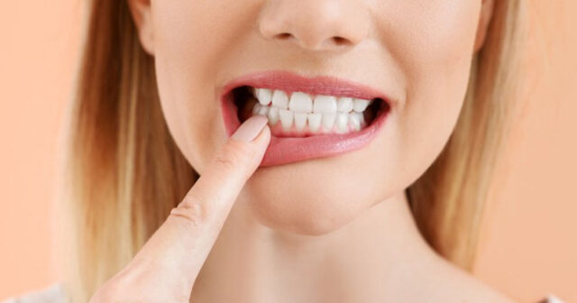 Dişlərdə ləkələr niyə yaranır?