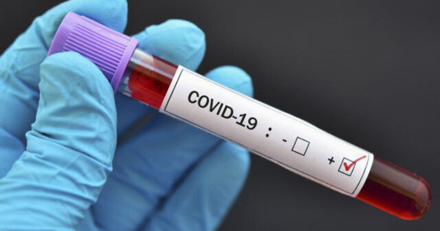 SN: Azərbaycanda COVID-19-a yoluxma halları olsa da, epidemioloji vəziyyət stabildir
