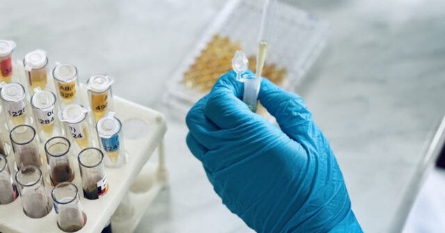 Rusiya Səhiyyə Nazirliyi hepatit C-nin yoxlanılması ilə bağlı tibbi müayinə proqramını genişləndirib