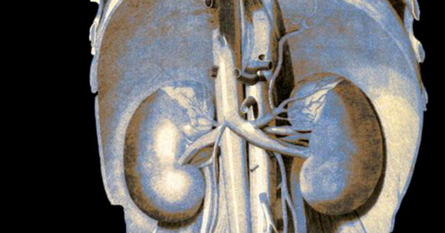 “Liver International”: Böyrəklər hepatit E virusunu gizlədə bilər