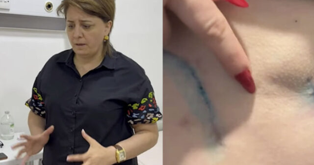 Daha bir “plastik cərrah” qalmaqalı – “Bədənim çürüyür”- VİDEO