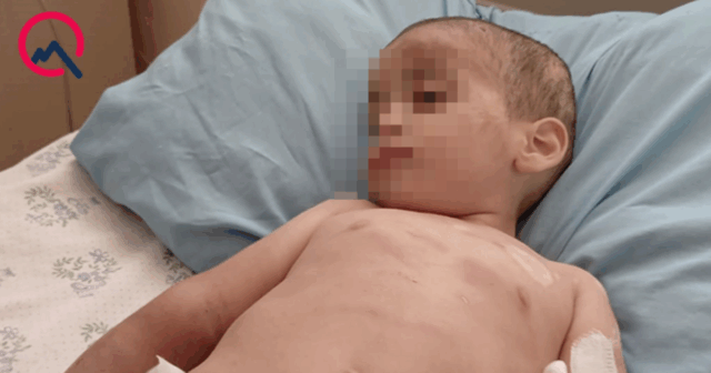 Valideynləri tərəfindən döyülən azyaşlının vəziyyəti ağırdır – TƏBİB