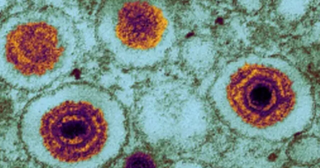 Alimlər yeni təhlükəli virus aşkarlayıblar