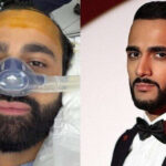 Hüseyn Həsənov tanınmaz halda – FOTO Hüseyn Həsənov tanınmaz halda – FOTO