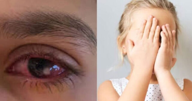 Bakıda uşağın gözü şirniyyat yeməkdən “xarab oldu” — Endokrinoloqdan xəbərdarlıq Bakıda uşağın gözü şirniyyat yeməkdən “xarab oldu” — Endokrinoloqdan xəbərdarlıq