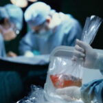 DİQQƏT: Reanimasiyada ölən hər kəsin orqanları götürülə bilər DİQQƏT: Reanimasiyada ölən hər kəsin orqanları götürülə bilər