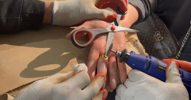 Barmağında sıxışan üzüyü belə çıxardılar – VİDEO