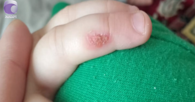 “3 yaşlı uşağım bağçada ağlayanda bıçağı qızdıraraq əlinə basıb” – Video